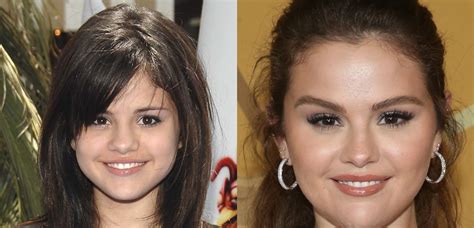 selena gomez boobs before and after|Selena Gomez Breast Implants Photos [Before & After]